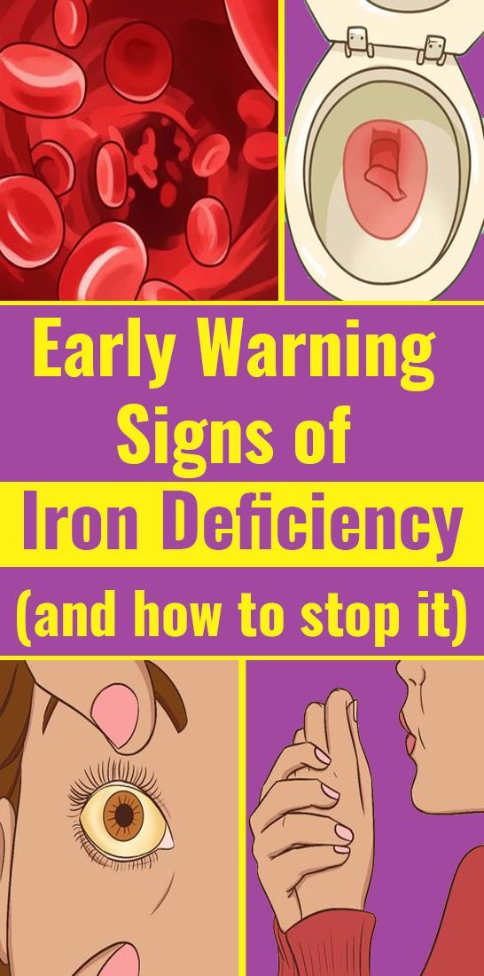 Never Ignore These Crucial Signs Of Iron Deficiency Wellness Magazine